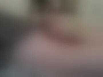 perio102